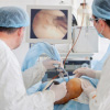 Arthroscopy