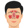 Septoplasty